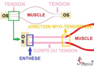 Qu’est-ce qu’une tendinite, différantes zones d'un tendon